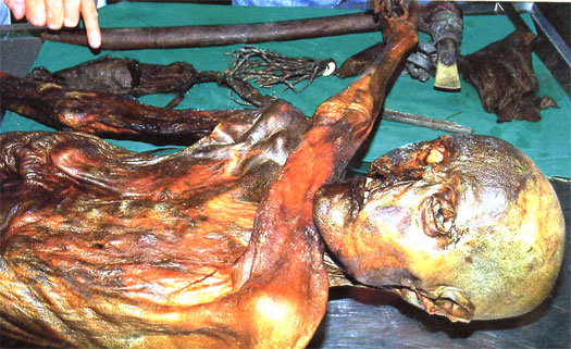 Ötzi fra Gletcheren